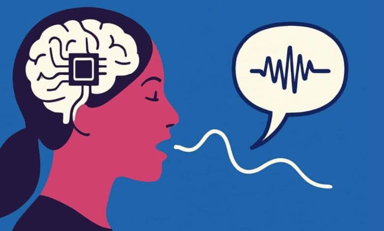 شريحة دماغية تحول الأفكار إلى كلمات